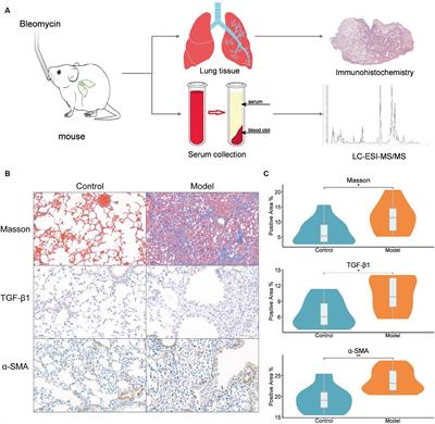 Metabolic profiling of idiopathic pulmonary fibrosis in a mouse model: implications for pathogenesis and biomarker discovery